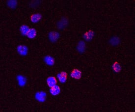 FOLR2 antibody in Human Neutrophils by Immunocytochemistry (ICC).