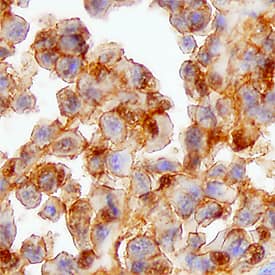 FOLR4 antibody in Human Melanoma by Immunohistochemistry (IHC-P).