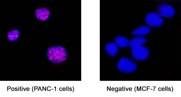 FOXL2 antibody in PANC-1 Human Cell Line by Immunocytochemistry (ICC).