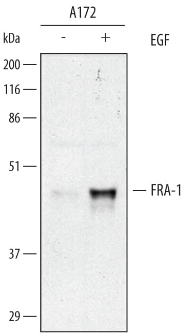 Detection of Human FRA-1 antibody by Western Blot.