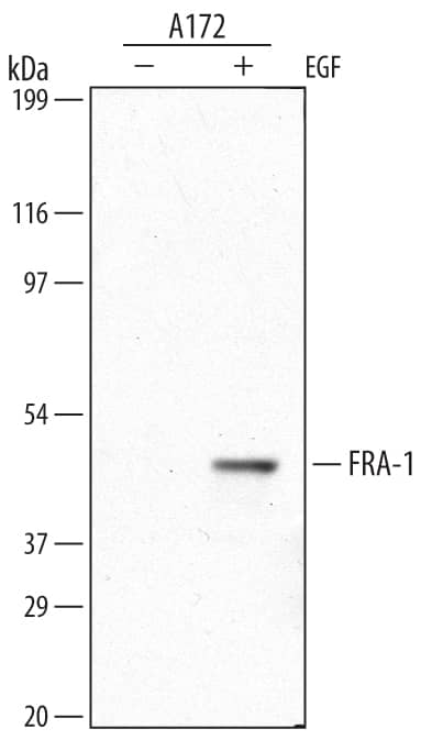 Detection of Human FRA-1 antibody by Western Blot.