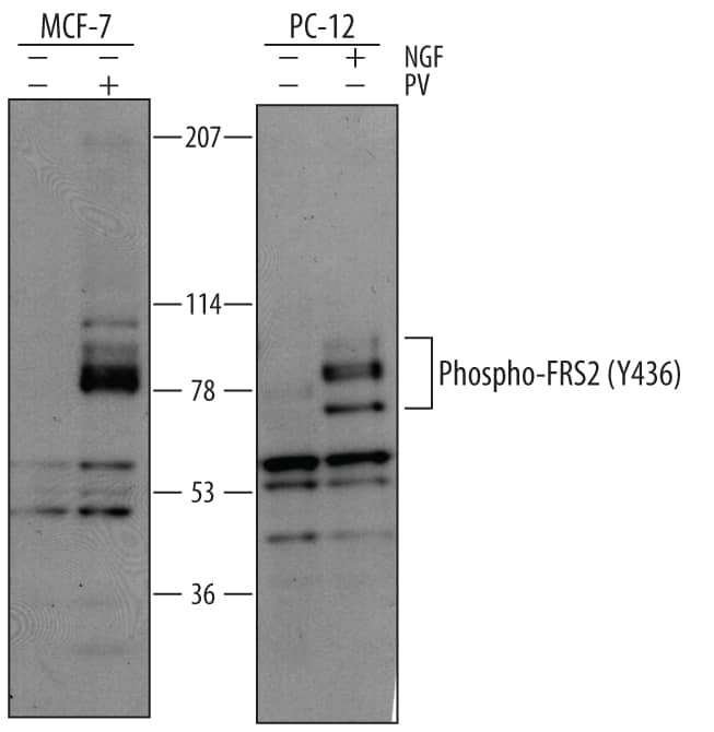 Detection of Human and Rat Phospho-FRS2 (Y436) antibody by Western Blot.