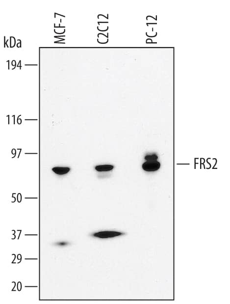 Detection of Human/Mouse/Rat FRS2 antibody by Western Blot.