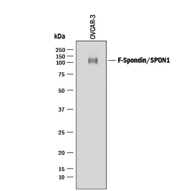 Detection of Human F-Spondin/SPON1 antibody by Western Blot.