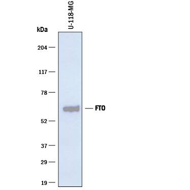 Detection of Human FTO antibody by Western Blot.