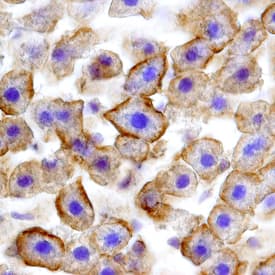 Fas/TNFRSF6/CD95 antibody in Rat Liver by Immunohistochemistry (IHC-Fr).