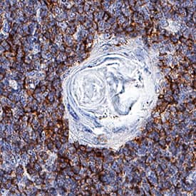 Fas Ligand/TNFSF6 antibody in Human Thymus by Immunohistochemistry (IHC-P).