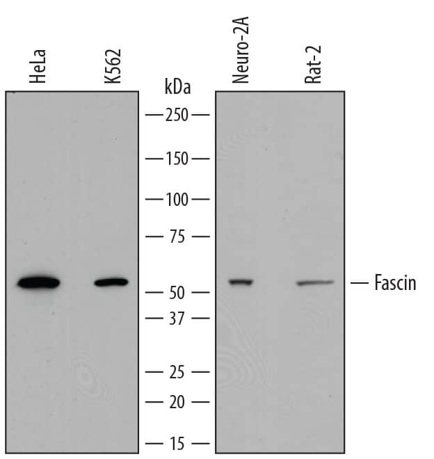 Detection of Human, Mouse, and Rat Fascin antibody by Western Blot.