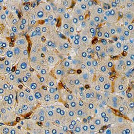 Fascin antibody in Human Liver by Immunohistochemistry (IHC-P).