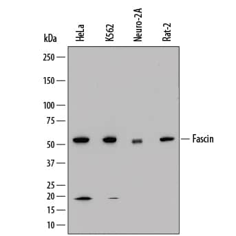 Detection of Human, Mouse, and Rat Fascin antibody by Western Blot.