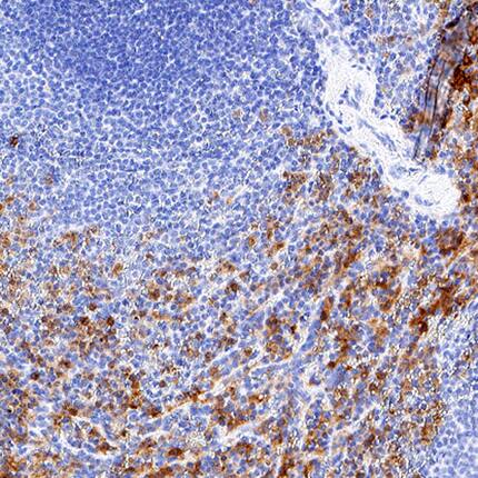 Fc gamma RIIIA/CD16a antibody in Human Spleen Tissue by Immunohistochemistry (IHC-P).