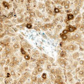 Fer antibody in Human Liver by Immunohistochemistry (IHC-P).