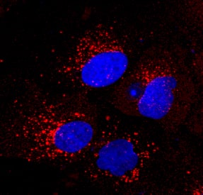 Ferritin antibody in iBJ6 iPS Cell Line by Immunocytochemistry (ICC).
