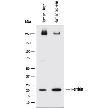 Detection of Human Ferritin antibody by Western Blot.