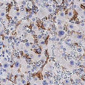 Ferroportin/SLC40A1 antibody in Human Liver by Immunohistochemistry (IHC-P).
