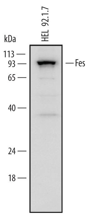 Detection of Human Fes antibody by Western Blot.