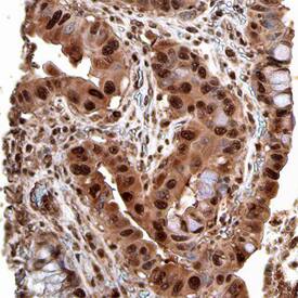 Fes antibody in Human Colon by Immunohistochemistry (IHC-P).