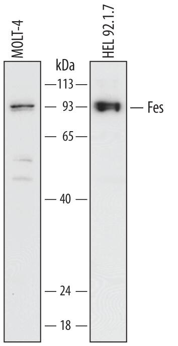 Detection of Human Fes antibody by Western Blot.