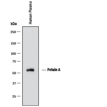 Detection of Human Fetuin A/AHSG antibody by Western Blot.