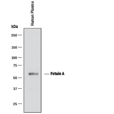 Detection of Human Fetuin A/AHSG antibody by Western Blot.