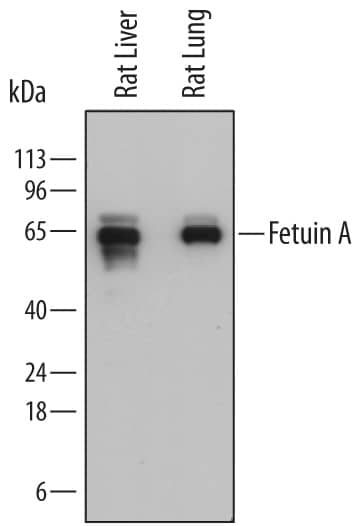 Detection of Rat Fetuin A/AHSG antibody by Western Blot.