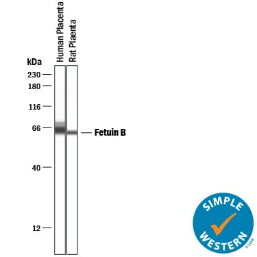 Detection of Human Fetuin B antibody by Simple WesternTM.