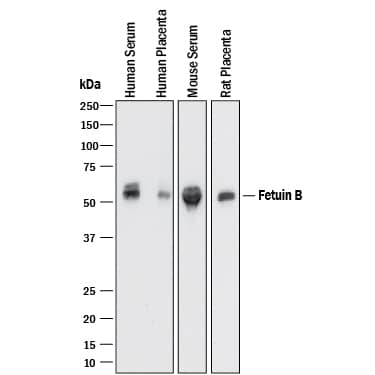 Detection of Human, Mouse, and Rat Fetuin B antibody by Western Blot.