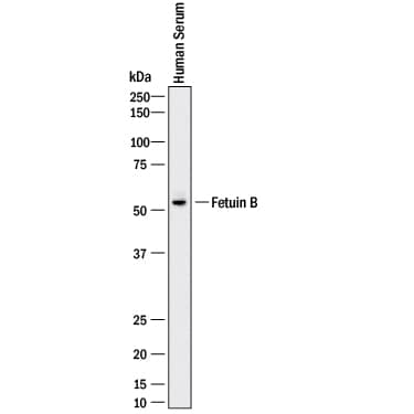 Detection of Human Fetuin B antibody by Western Blot.