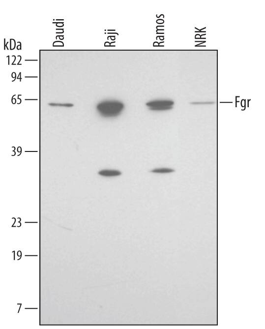 Detection of Human and Rat Fgr antibody by Western Blot.