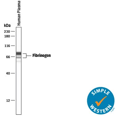 Detection of Human Fibrinogen antibody by Simple WesternTM.