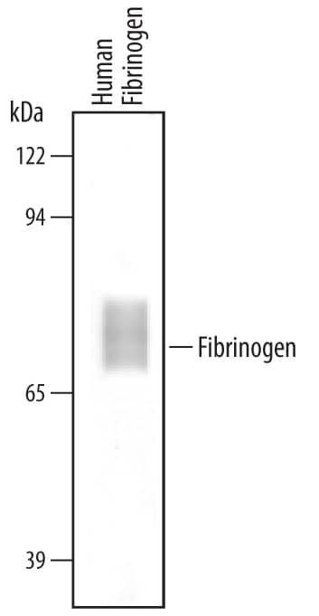 Detection of Human Fibrinogen antibody by Western Blot.