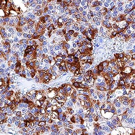 Fibrinogen A antibody in Human Liver by Immunohistochemistry (IHC-P).