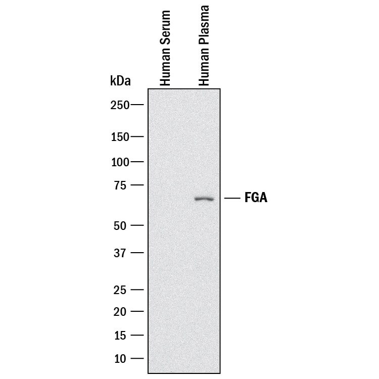 Detection of Human Fibrinogen A antibody by Western Blot.