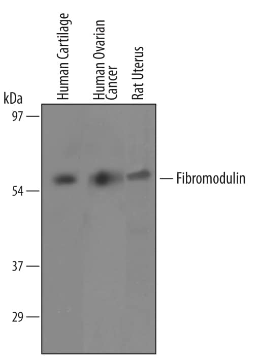 Detection of Human/Mouse/Rat Fibromodulin antibody by Western Blot.