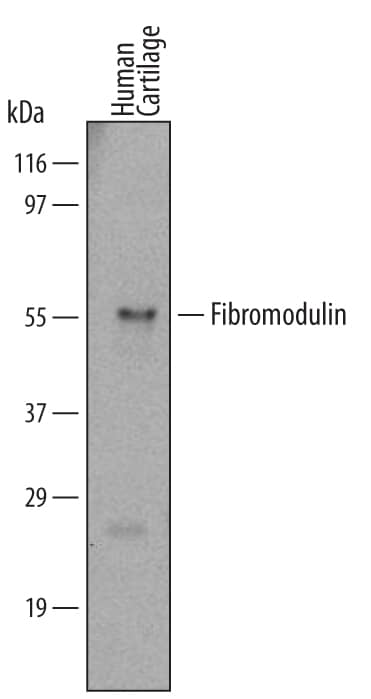 Detection of Human Fibromodulin antibody by Western Blot.