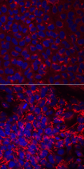 Fibronectin antibody in A549 Human Cell Line by Immunocytochemistry (ICC).