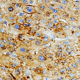 Fibronectin antibody in Human Liver by Immunohistochemistry (IHC-P).