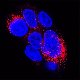 Fibronectin antibody in HepG2 Human Cell Line by Immunocytochemistry (ICC).