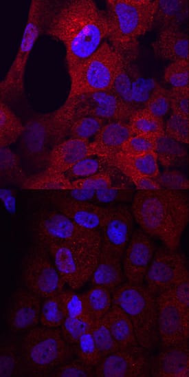 Phospho-Flt-3/Flk-2 (Y591) antibody in A431 Human Cell Line by Immunocytochemistry (ICC).