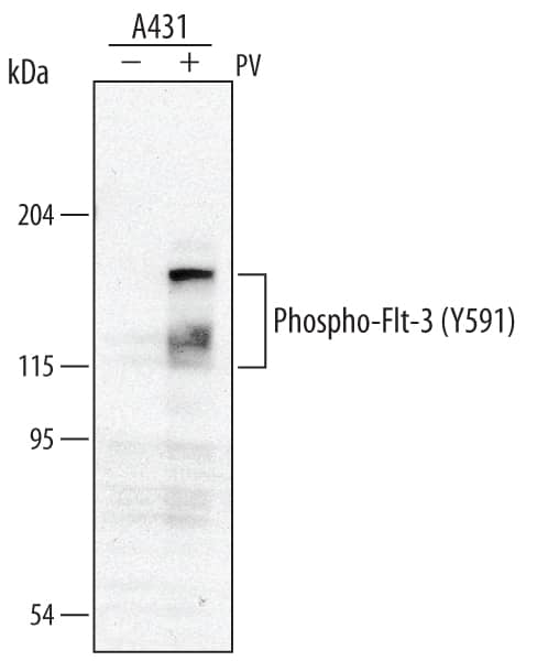 Detection of Human Phospho-Flt-3/Flk-2 (Y591) antibody by Western Blot.