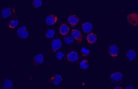 Flt-3/Flk-2 antibody in M1 Mouse Cell Line by Immunocytochemistry (ICC).