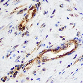 Follistatin antibody in Human Breast by Immunohistochemistry (IHC-P).