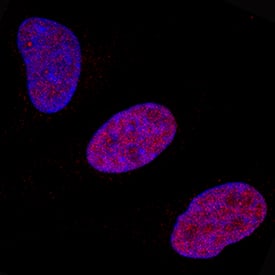 FosB/G0S3 antibody in HeLa Human Cell Line by Immunocytochemistry (ICC).