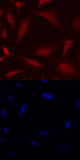 FoxC2 antibody in HeLa Human Cell Line by Immunocytochemistry (ICC).