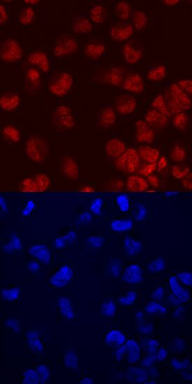 FoxC2 antibody in MDA-MB-453 Human Cell Line by Immunocytochemistry (ICC).