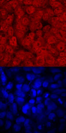 FoxD3 antibody in BG01V Human Stem Cells by Immunocytochemistry (ICC).