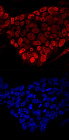 FoxD3 antibody in D3 Mouse Stem Cell Line by Immunocytochemistry (ICC).