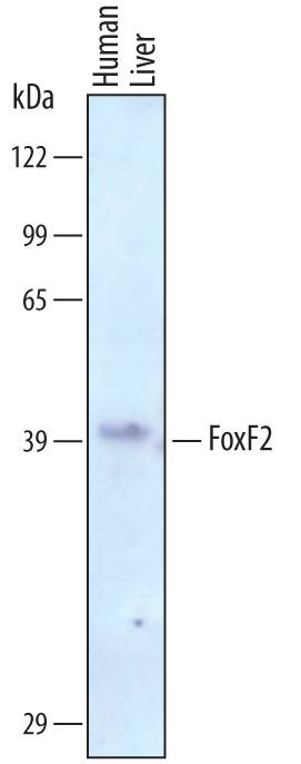 Detection of Human FoxF2 antibody by Western Blot.