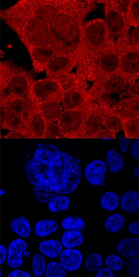 FoxJ1 antibody in HEK293 Human Cell Line by Immunocytochemistry (ICC).