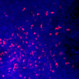 FoxJ1 antibody in Early Proximal Lung Progenitors by Immunocytochemistry (ICC).